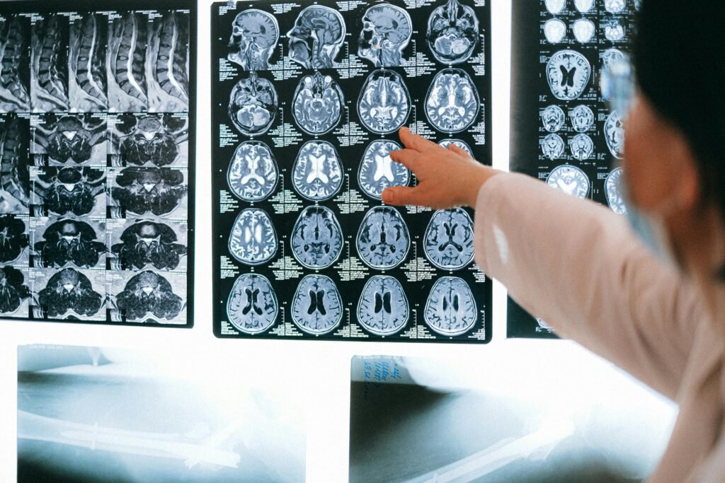 Bachelor Courses Radiologist pointing at brain MRI scans showing detailed medical examination.